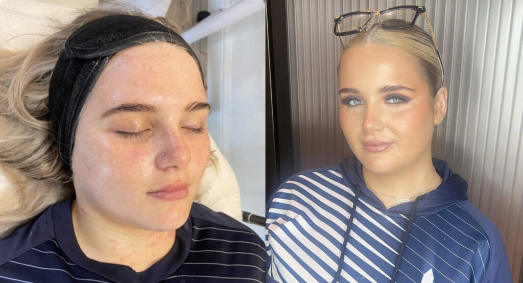 Before and after makeup transformation